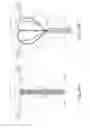 Fig. 60 - METHOD AND DEVICE FOR DISTENDING A GYNECOLOGICAL CAVITY