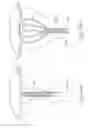 Fig. 61 - METHOD AND DEVICE FOR DISTENDING A GYNECOLOGICAL CAVITY