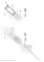 Fig. 70 - METHOD AND DEVICE FOR DISTENDING A GYNECOLOGICAL CAVITY