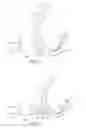 Fig. 05 - Cervical cerclage assistance device