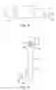 Fig. 09 - Cervical cerclage assistance device
