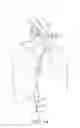 Fig. 14 - Cervical cerclage assistance device