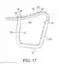 Fig. 17 - Cervical cerclage assistance device