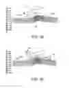 Fig. 05 - Easy glide abrasive tip for a microdermabrasion device