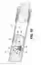 Fig. 04 - Orthopedic extendable rods