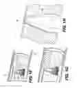Fig. 05 - Orthopedic extendable rods