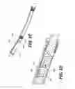 Fig. 07 - Orthopedic extendable rods