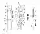 Fig. 14 - Orthopedic extendable rods