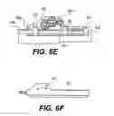 Fig. 16 - Orthopedic extendable rods