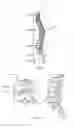 Fig. 03 - Spinal deformity correction