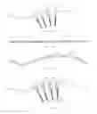 Fig. 13 - Spinal deformity correction