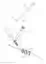 Fig. 17 - Spinal deformity correction
