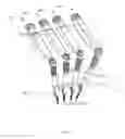 Fig. 18 - Spinal deformity correction