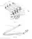 Fig. 19 - Spinal deformity correction