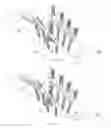 Fig. 29 - Spinal deformity correction