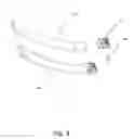 Fig. 04 - Guided rod and anchor system for use in a minimally invasive surgery spinal procedure or the like