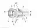 Fig. 10 - Multi-axial spinal fixation system