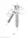 Fig. 02 - Spinal implant system and method