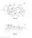 Fig. 03 - Spinal implant system and method