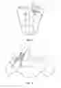 Fig. 10 - Spinal implant system and method