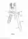 Fig. 13 - Spinal implant system and method