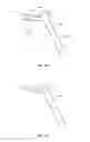 Fig. 15 - Spinal implant system and method