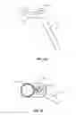 Fig. 16 - Spinal implant system and method