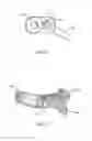 Fig. 17 - Spinal implant system and method