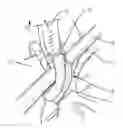 Fig. 01 - SURGICAL SYSTEM AND METHOD
