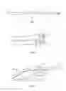 Fig. 02 - SURGICAL SYSTEM AND METHOD