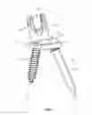 Fig. 02 - Spinal implant system and method