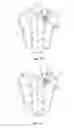 Fig. 07 - Spinal implant system and method