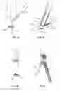 Fig. 14 - Spinal implant system and method