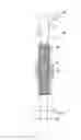 Fig. 01 - Fracture fixation systems