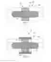 Fig. 02 - Fracture fixation systems