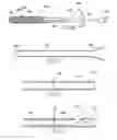 Fig. 21 - Fracture fixation systems