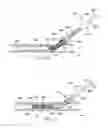 Fig. 22 - Fracture fixation systems