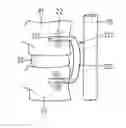 Fig. 01 - Anterior cervical plate