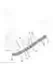 Fig. 01 - Bone fixation system
