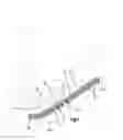 Fig. 02 - Bone fixation system