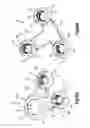 Fig. 27 - Bone fixation system