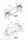 Fig. 28 - Bone fixation system