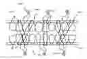 Fig. 01 - Intermaxillary fixation device and method of using same