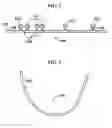 Fig. 02 - Intermaxillary fixation device and method of using same