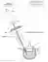 Fig. 01 - Bone treatment systems and methods
