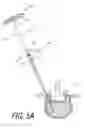 Fig. 06 - Bone treatment systems and methods
