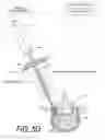 Fig. 09 - Bone treatment systems and methods