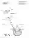 Fig. 12 - Bone treatment systems and methods