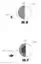 Fig. 19 - Bone treatment systems and methods