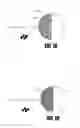 Fig. 20 - Bone treatment systems and methods